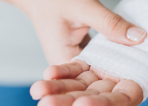 A hand wrapped in gauze and bandages