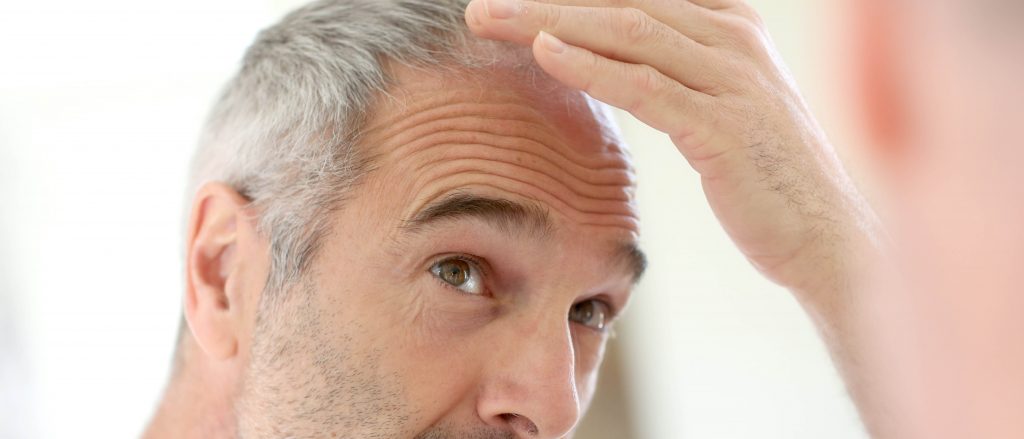 Older man dealing with hair loss