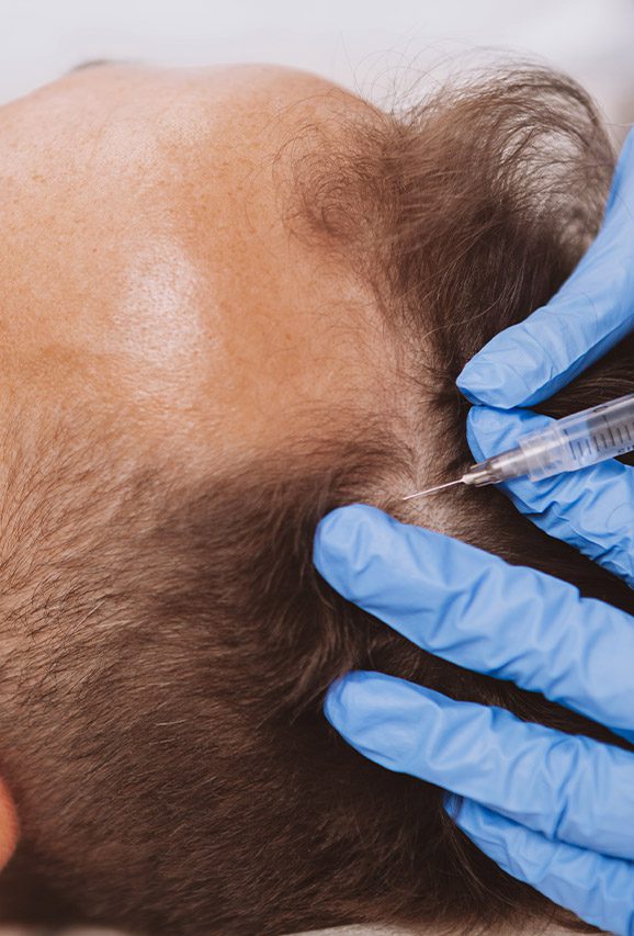 Man getting an injection on the scalp