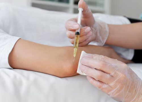 PRP Therapy for Joint Pain & Injuries