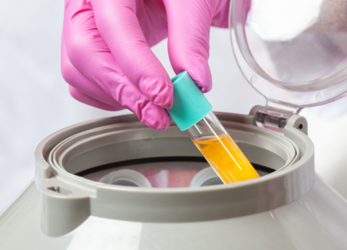 Platelet-Rich Plasma (PRP)