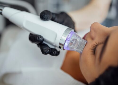 How To Fix Dull, Aging Skin With PRP And Microneedling