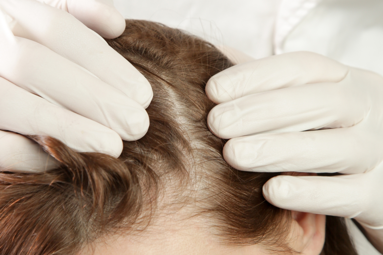5 Causes Of Thinning Hair and What Actually Works