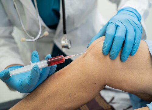 Here’s What Is Better Than Cortisone For Joint Pain